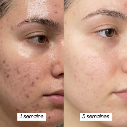 PEAU GRASSE - MASQUE JELLY