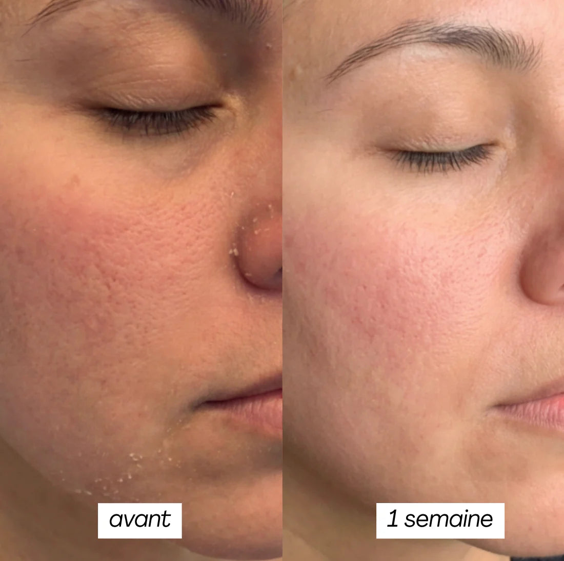 PEAU SÈCHE - MASQUE JELLY