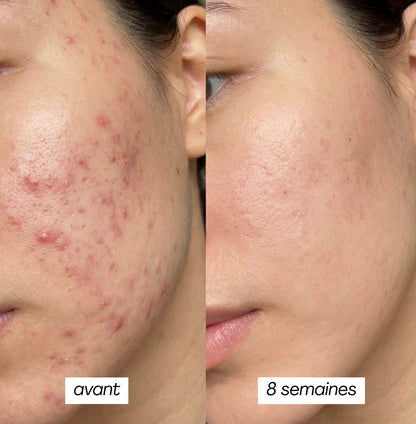 PEAU GRASSE - MASQUE JELLY