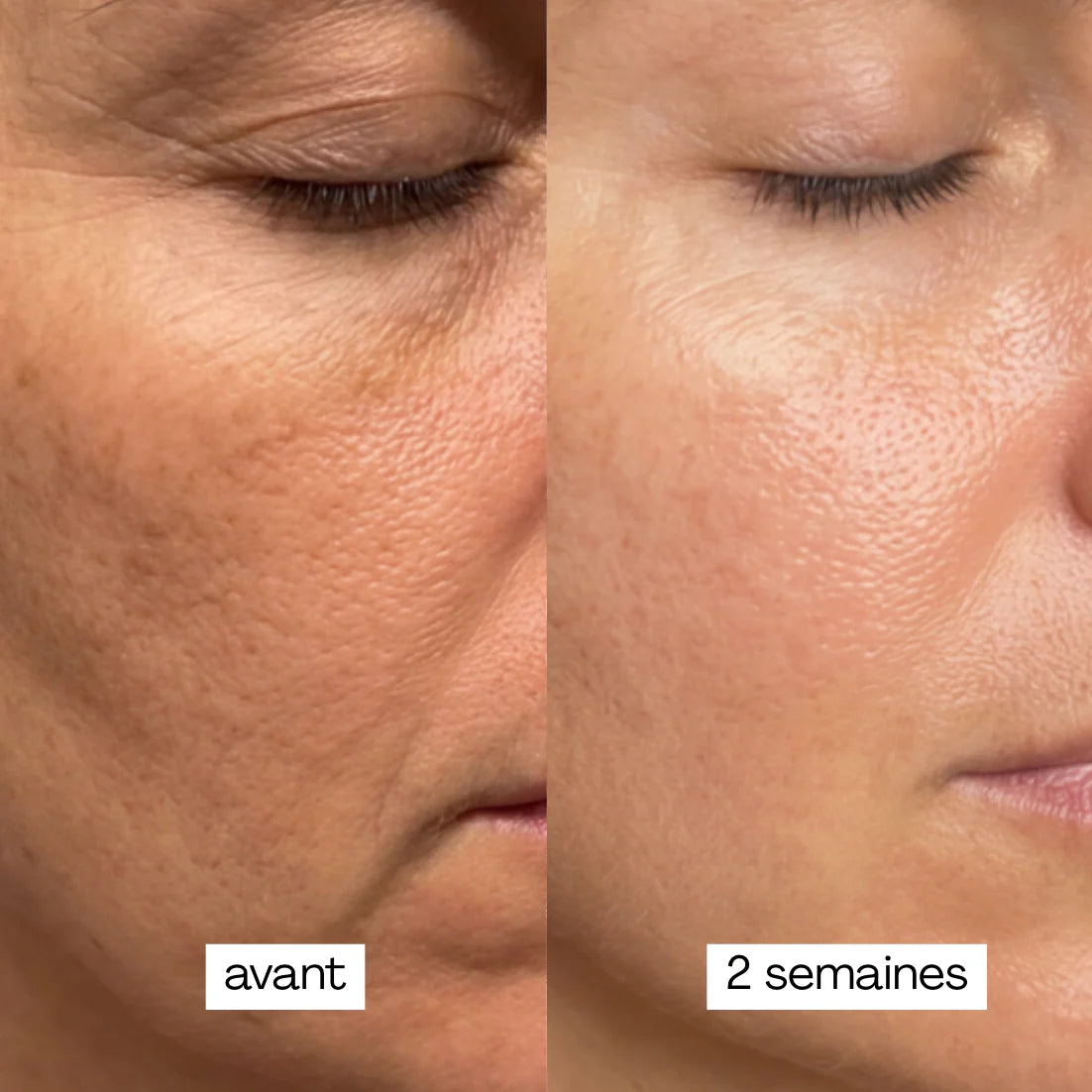 PEAU MATURE - MASQUE JELLY