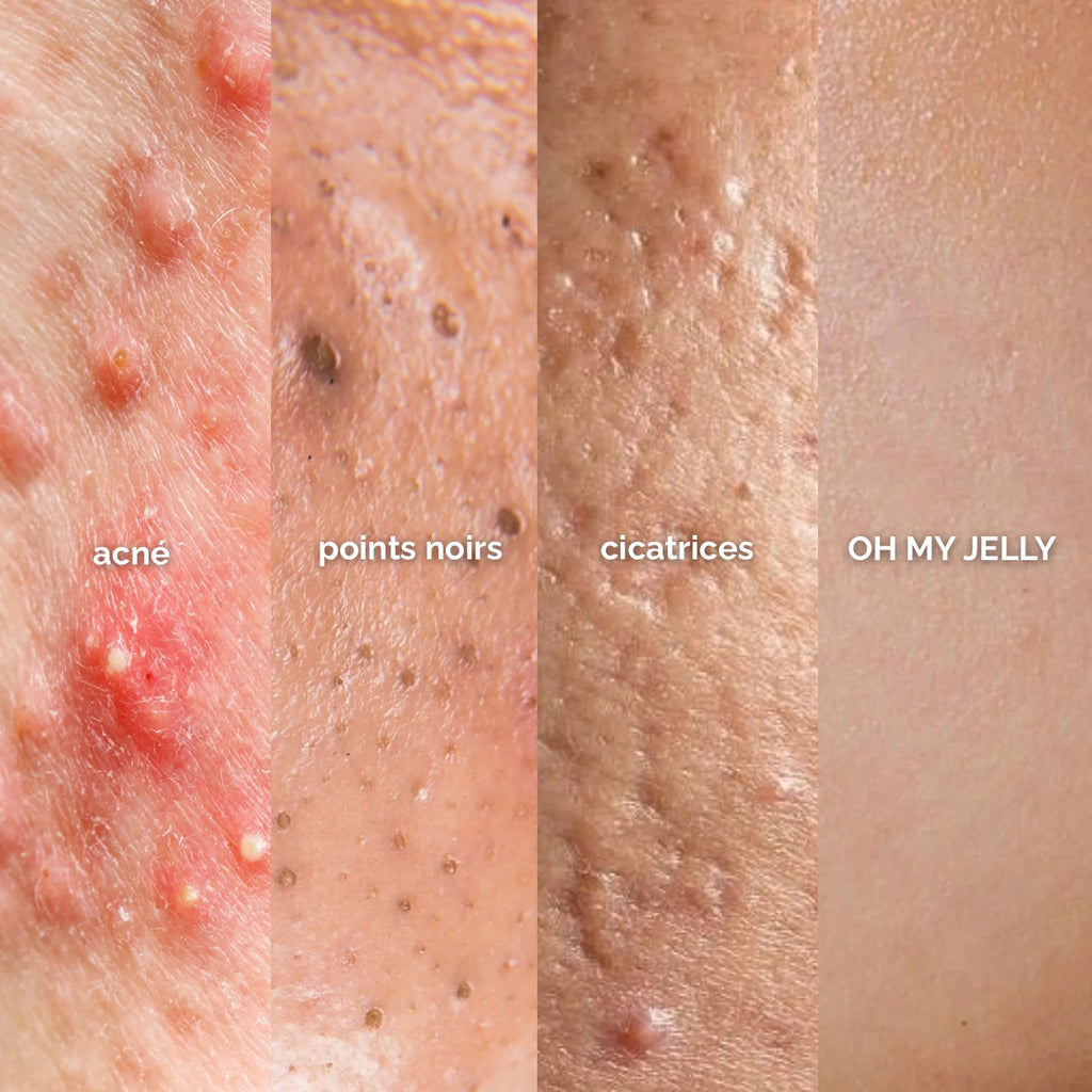 PEAU GRASSE - MASQUE JELLY