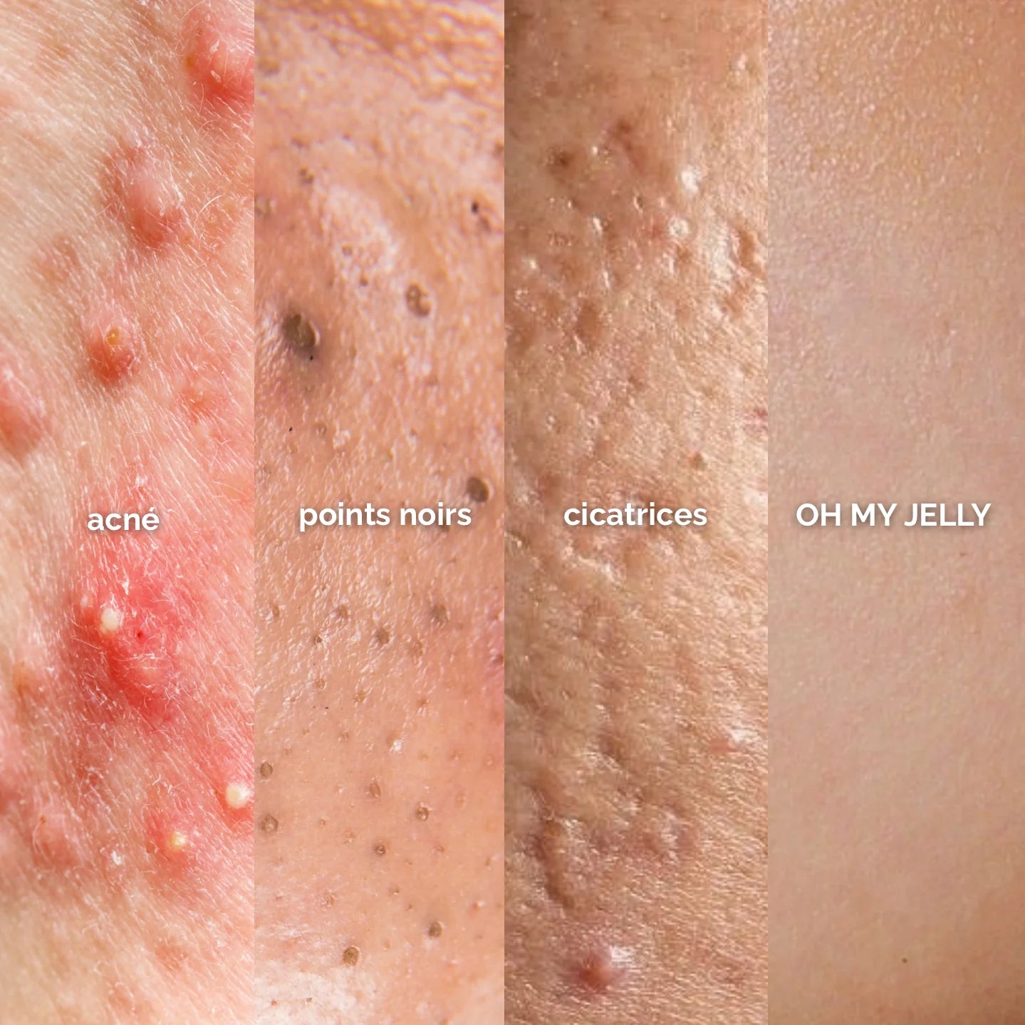 PEAU GRASSE - MASQUE JELLY