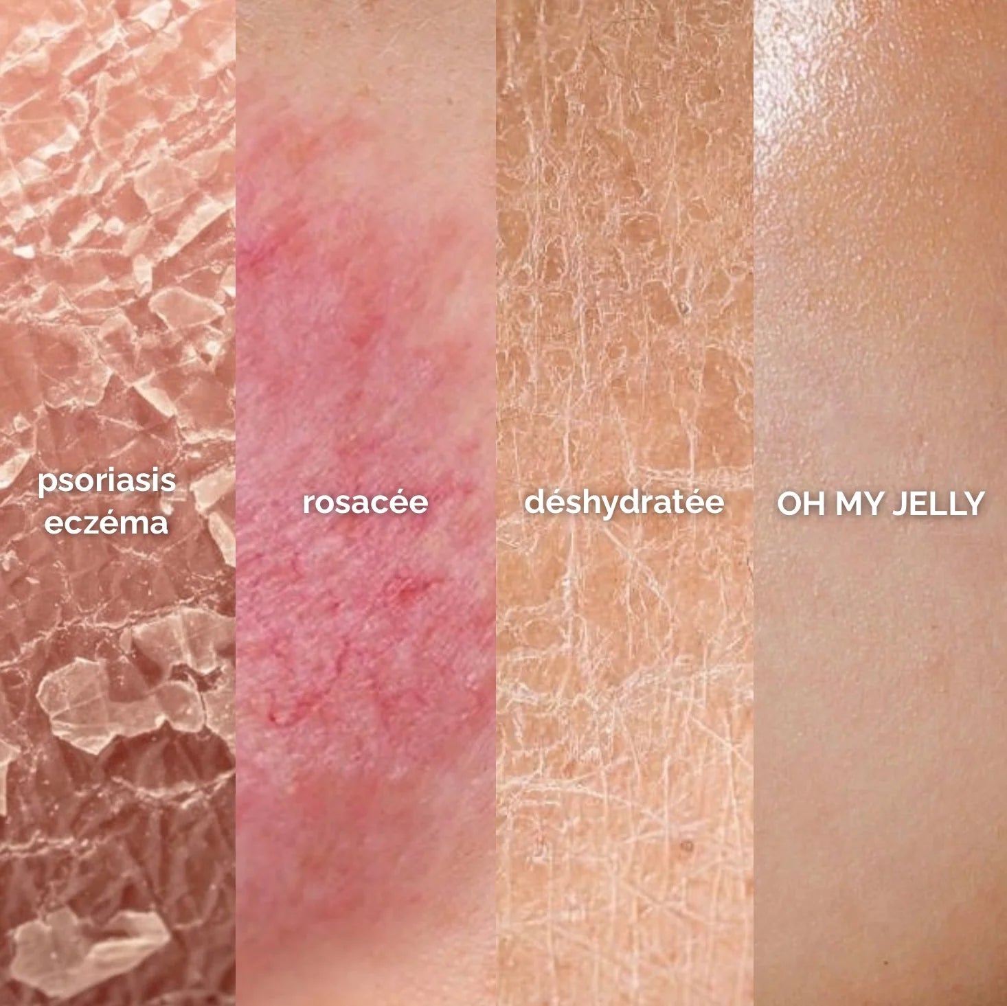 PEAU SÈCHE - MASQUE JELLY